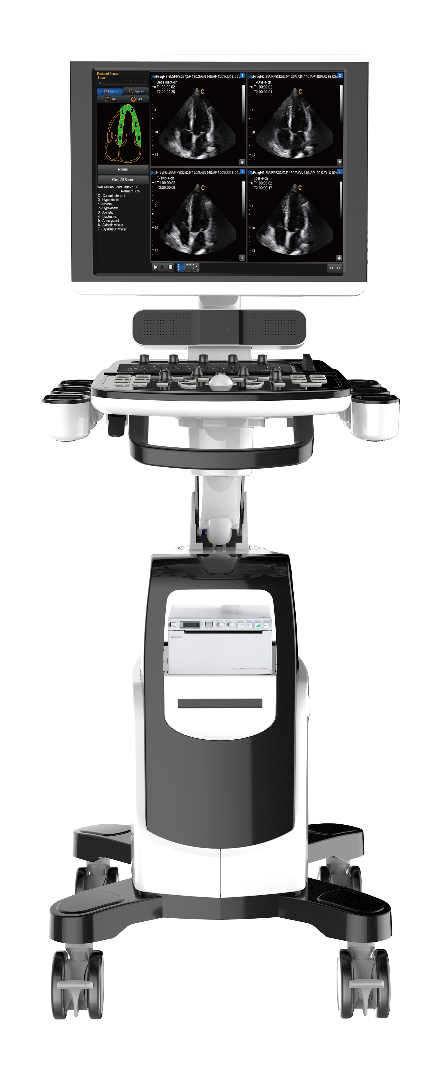 19 Inch HD Trolley Color Doppler Ultrasound