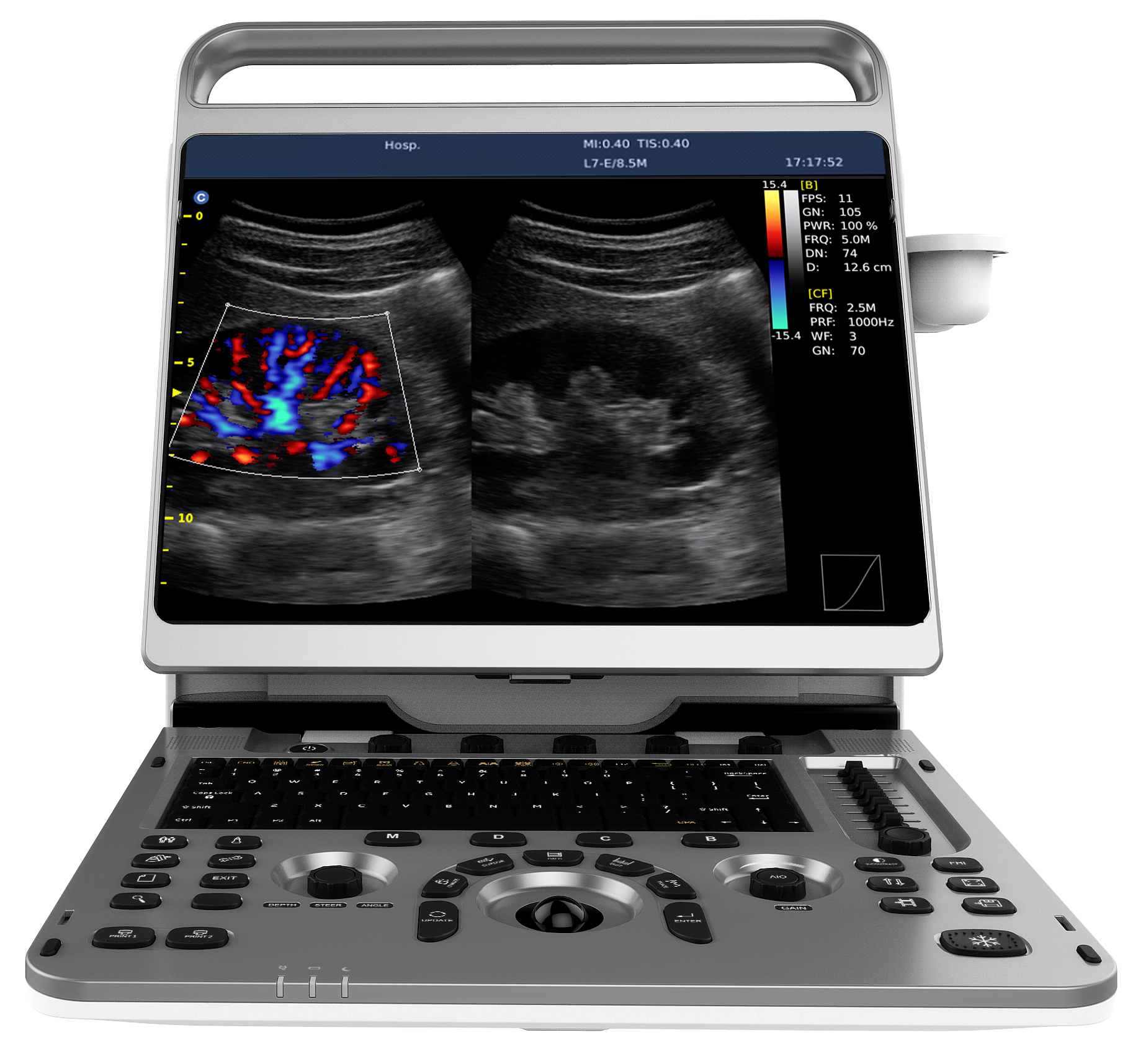 15 Inch HD Portable Color Doppler Ultrasound