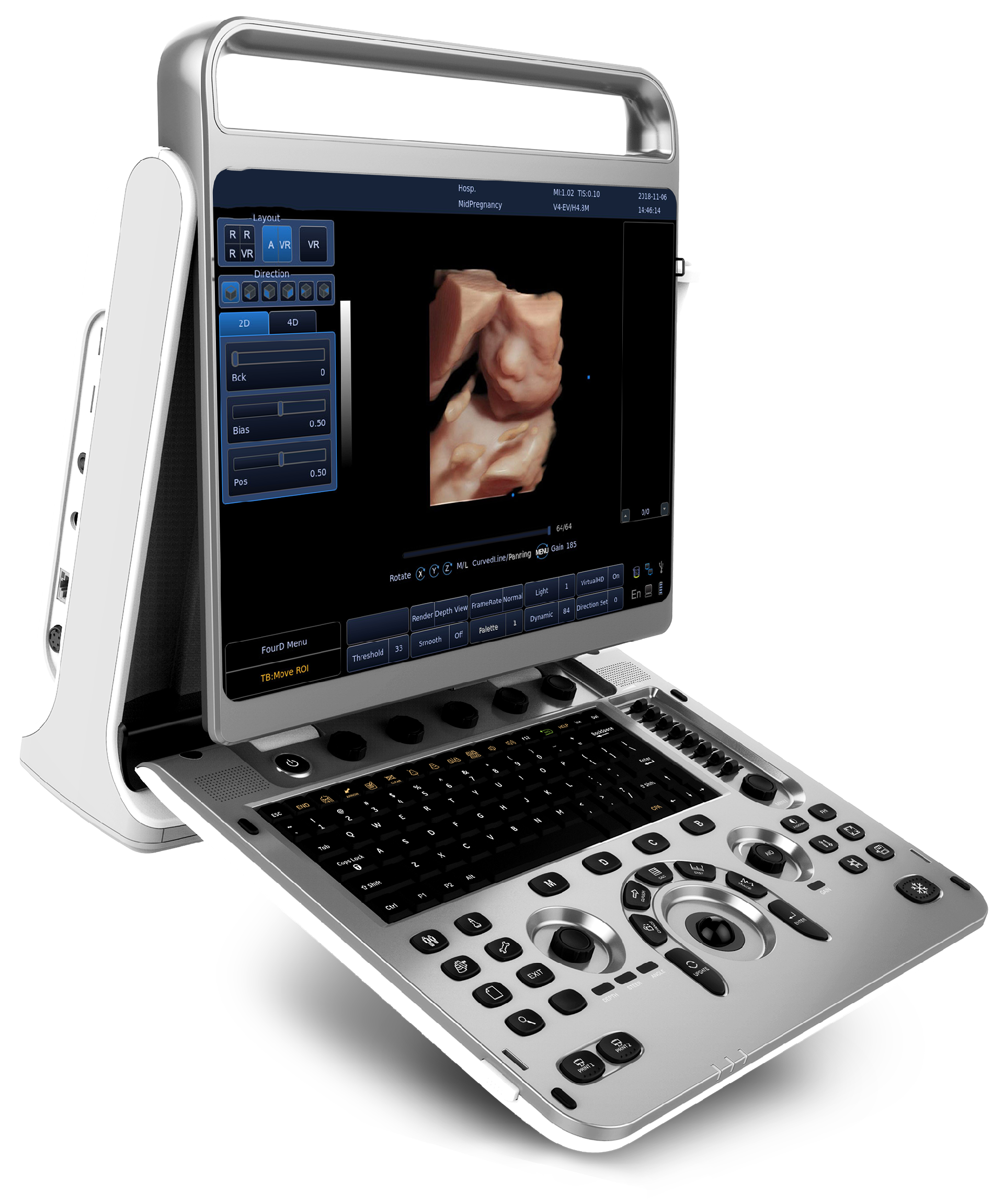 15 Inch Portable Color Doppler Ultrasound