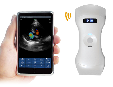 Palm doppler ultrasound 3 in1