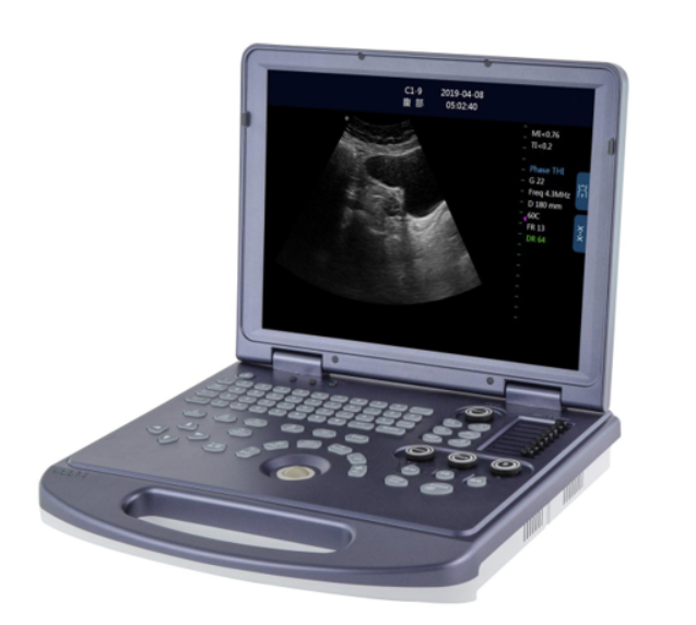 15.6 inch Portable High-level B&W Ultrasound Scanner