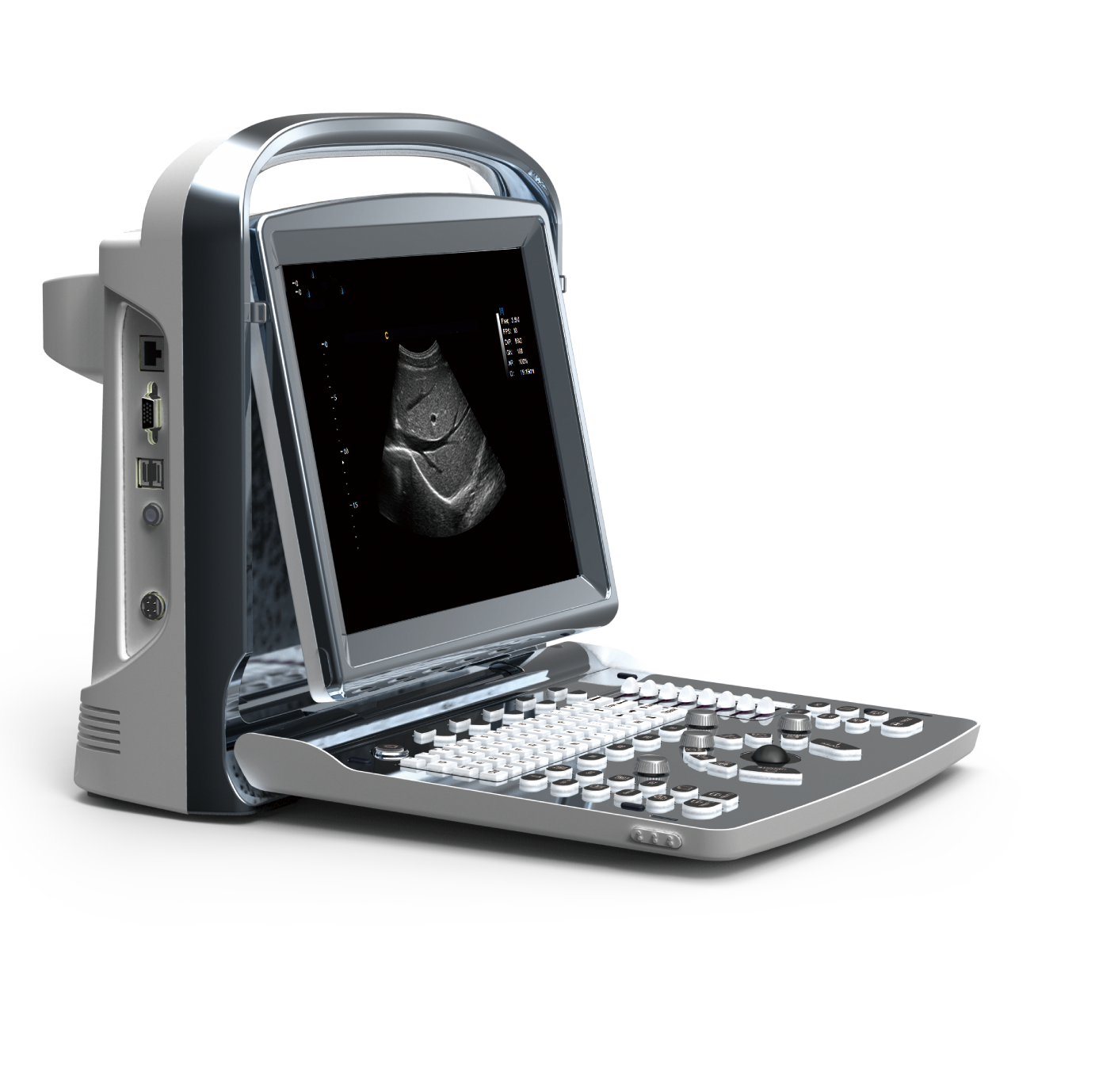 12 inch Laptop B&W Ultrasound