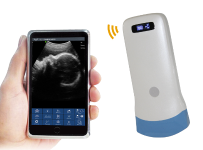 Palm B/W ultrasound Convex