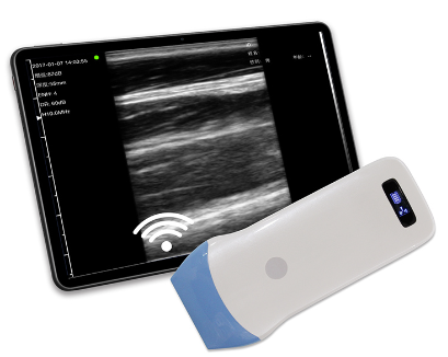 Palm B/W ultrasound Linear