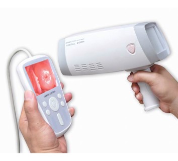 Handheld Colposcope