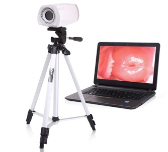 Portable Colposcope