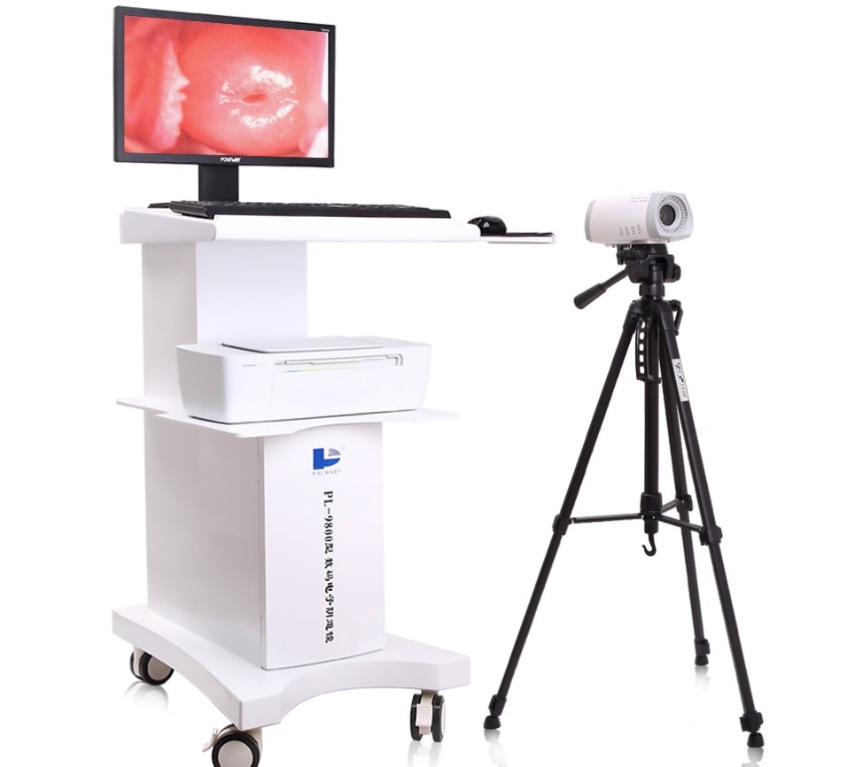 Trolley Video Colposcope System