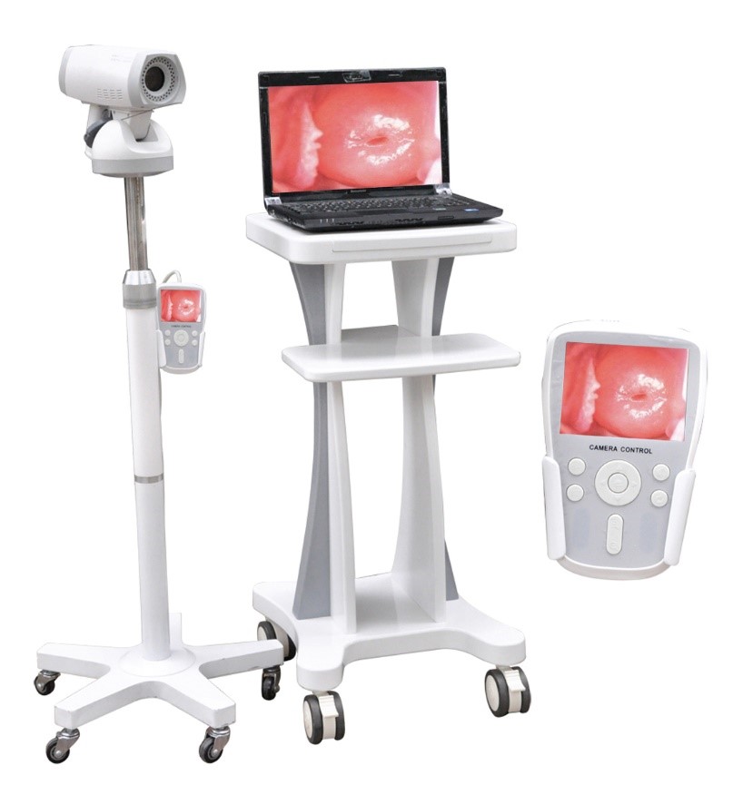 Trolley Video Colposcope System