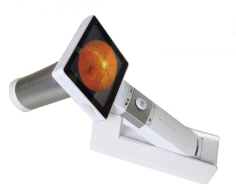 Handheld Non-mydriatic Fundus Camera