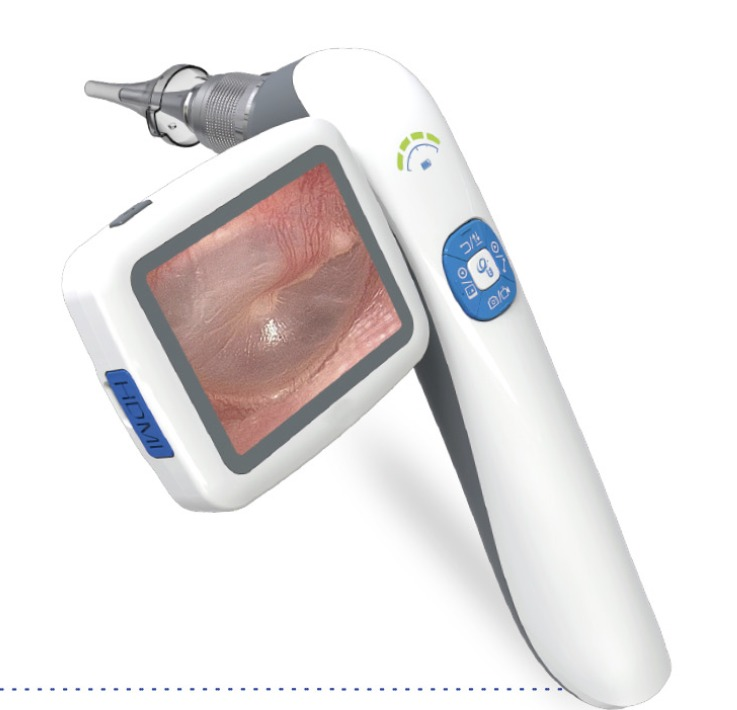 Video Otoscope