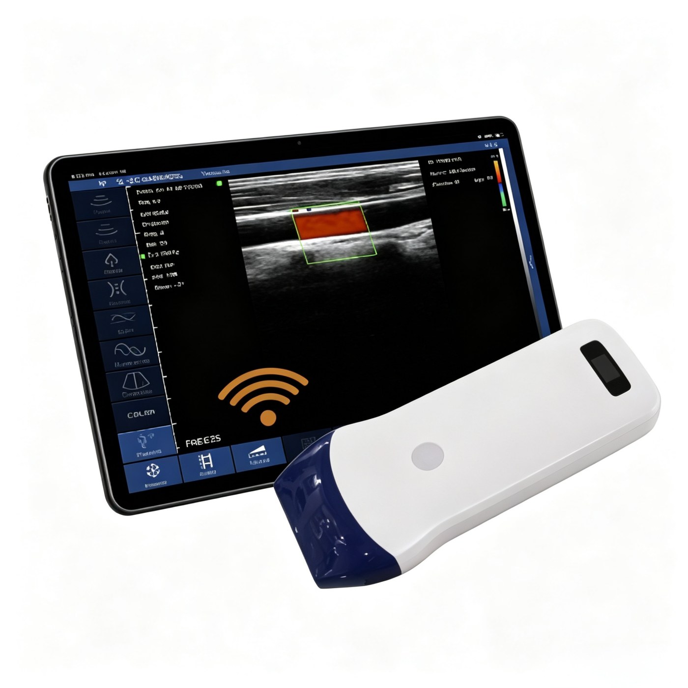 Veterinary Palm Doppler Ultrasound with Linear Probe | Portable Animal Ultrasound Equipment